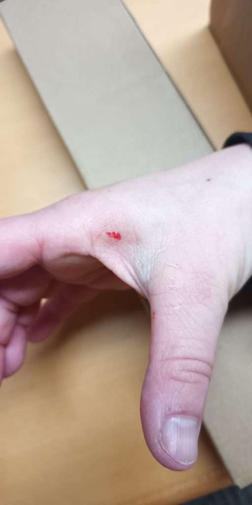 Eine Wunde an der Hand nach Eigenarbeit